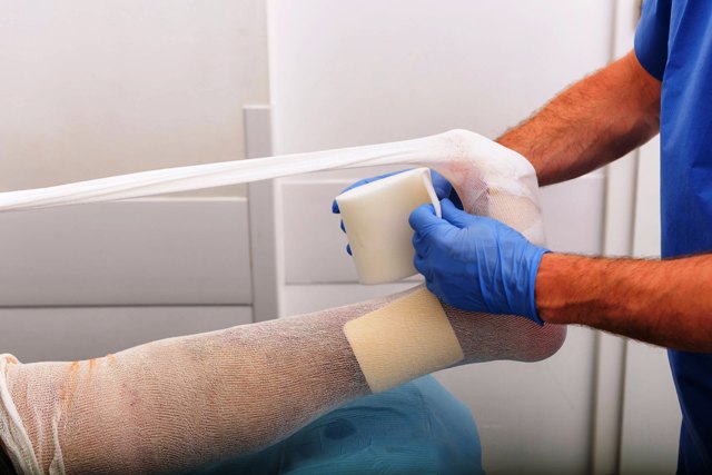 Leg Cast Unsplash